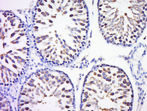 Paraformaldehyde-fixed, paraffin embedded rat testis; Antigen retrieval by boiling in sodium citrate buffer (pH6) for 15min; Block endogenous peroxidase by 3% hydrogen peroxide for 30 minutes; Blocking buffer (BSA or normal goat serum) at 37°C for 20min; Antibody incubation with Rad51 Polyclonal Antibody, Unconjugated (bs-20297R) at 1:200 overnight at 4°C, followed by a conjugated secondary (sp-0023) for 20 minutes and DAB staining. Paraformaldehyde-fixed, paraffin embedded rat testis; Antigen retrieval by boiling in sodium citrate buffer (pH6) for 15min; Block endogenous peroxidase by 3% hydrogen peroxide for 30 minutes; Blocking buffer (BSA or normal goat serum) at 37°C for 20min; Antibody incubation with Rad51 Polyclonal Antibody, Unconjugated (bs-20297R) at 1:200 overnight at 4°C, followed by a conjugated secondary (sp-0023) for 20 minutes and DAB staining.