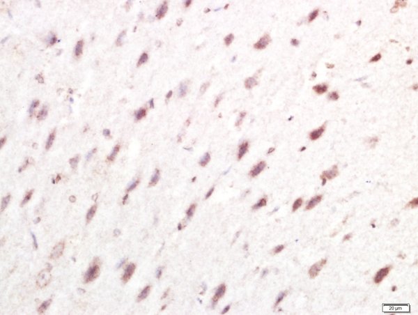 Paraformaldehyde-fixed, paraffin embedded rat brain tissue; Antigen retrieval by boiling in sodium citrate buffer(pH6) for 15min; Block endogenous peroxidase by 3% hydrogen peroxide for 30 minutes; Blocking buffer (normal goat serum) at 37°C for 20min; Antibody incubation with Rabbit Anti-IRF7 Polyclonal Antibody, Unconjugated (bs-2994R) at 1:400 overnight at 4°C, followed by a conjugated secondary and DAB staining