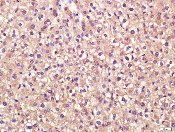 Paraformaldehyde-fixed, paraffin embedded mouse liver tissue; Antigen retrieval by boiling in sodium citrate buffer(pH6) for 15min; Block endogenous peroxidase by 3% hydrogen peroxide for 30 minutes; Blocking buffer (normal goat serum) at 37°C for 20min; Antibody incubation with Rabbit Anti-Stabilin 2 Polyclonal Antibody, Unconjugated (bs-12346R) at 1:400 overnight at 4°C, followed by a conjugated secondary and DAB staining