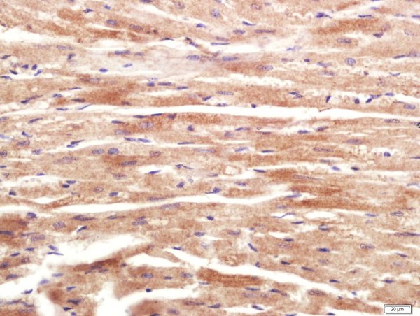Paraformaldehyde-fixed, paraffin embedded Mouse heart tissue; Antigen retrieval by boiling in sodium citrate buffer(pH6) for 15min; Block endogenous peroxidase by 3% hydrogen peroxide for 20 minutes; Blocking buffer (normal goat serum) at 37°C for 30min; Antibody incubation with RNF169 Polyclonal Antibody, Unconjugated (bs-9259R) at 1:400 overnight at 4°C, followed by a conjugated secondary and DAB staining