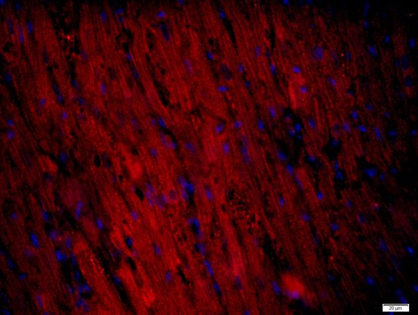 Paraformaldehyde-fixed, paraffin embedded Mouse heart tissue; Antigen retrieval by boiling in sodium citrate buffer(pH6) for 15min; Block endogenous peroxidase by 3% hydrogen peroxide for 20 minutes; Blocking buffer (normal goat serum) at 37°C for 30min; Antibody incubation with RNF169 Polyclonal Antibody, Unconjugated (bs-9259R) at 1:400 overnight at 4°C, followed by a conjugated secondary and DAPI staining