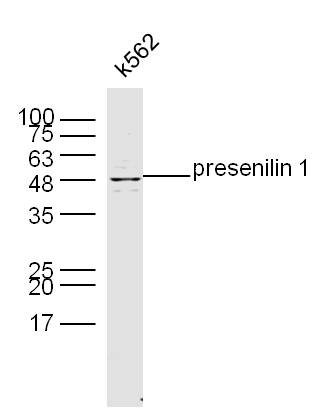 K562 Cell lysates probed with presenilin 1 Polyclonal Antibody, unconjugated (bs-0024R) at 1:300 overnight at 4\u00b0C followed by a conjugated secondary antibody at 1:10000 for 60 minutes at 37\u00b0C.