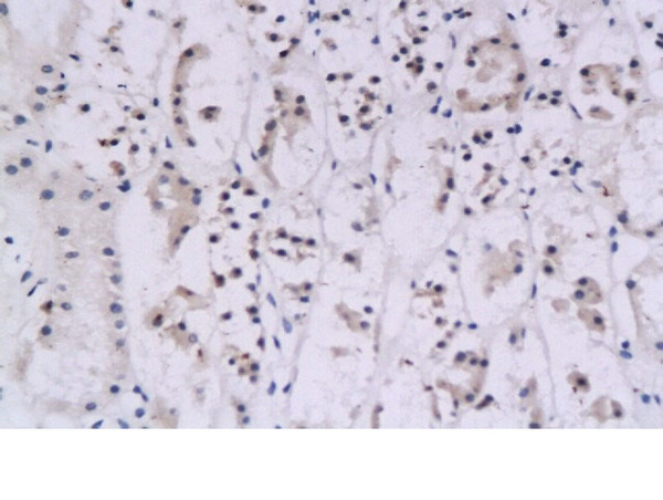 Formalin-fixed and paraffin-embedded human kidney tissue labeled with Rabbit Anti- IFN-gamma \nPolyclonal Antibody, Unconjugated (bs-0481R) at 1:200 followed by conjugation to the secondary \nantibody and DAB staining