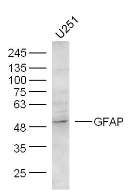 U251 Cells lysates probed with GFAP Polyclonal Antibody, unconjugated (bs-0199R) at 1:300 overnight at 4°C followed by a conjugated secondary antibody at 1:10000 for 60 minutes at 37°C.