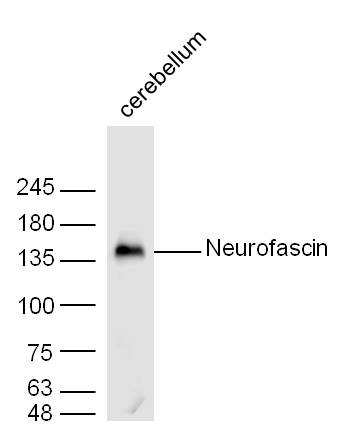 Mouse cerebellum lysates probed with Neurofascin Polyclonal Antibody, unconjugated (bs-0289R) at 1:300 overnight at 4\u00b0C followed by a conjugated secondary antibody at 1:10000 for 60 minutes at 37\u00b0C.