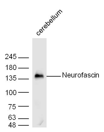 Mouse cerebellum lysates probed with Neurofascin Polyclonal Antibody, unconjugated (bs-0289R) at 1:300 overnight at 4°C followed by a conjugated secondary antibody at 1:10000 for 60 minutes at 37°C.