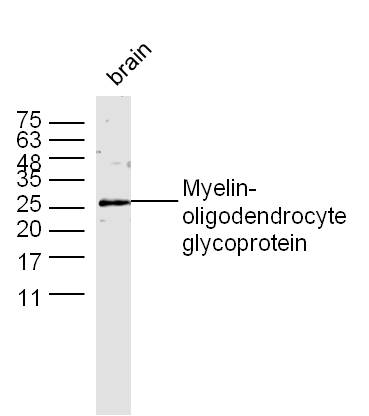 Mouse brain lysates probed with MOG Polyclonal Antibody, unconjugated (bs-0426R) at 1:300 overnight at 4°C followed by a conjugated secondary antibody at 1:10000 for 60 minutes at 37°C.