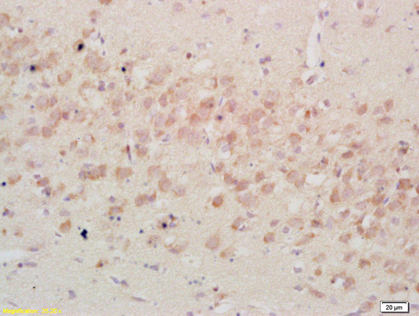 Formalin-fixed and paraffin embedded rat brain tissue labeled Anti-IGFBP3 Polyclonal Antibody, Unconjugated (bs-1434R) at 1:200, followed by conjugation to the secondary antibody and DAB staining