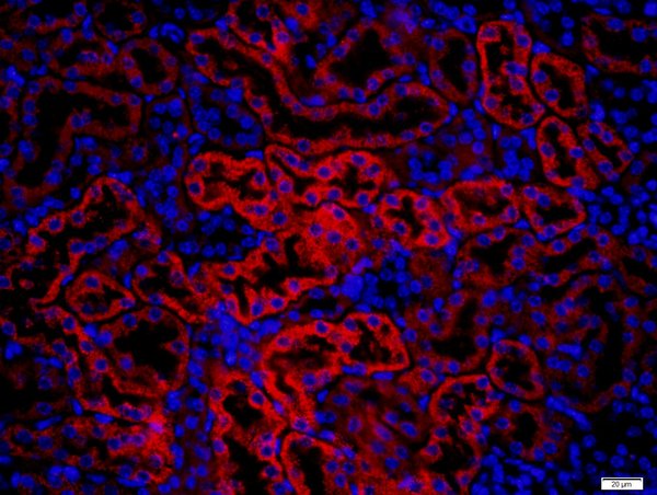Paraformaldehyde-fixed, paraffin embedded mouse kidney; Antigen retrieval by boiling in sodium citrate buffer (pH6) for 15min; Block endogenous peroxidase by 3% hydrogen peroxide for 20 minutes; Blocking buffer (normal goat serum) at 37°C for 30min; Antibody incubation with KRAS Polyclonal Antibody, Unconjugated (bs-1033R) at 1:400 overnight at 4°C, followed by a conjugated secondary (Goat Anti-rabbit IgG/Bio) for 20minutes at 37°C, followed by a conjugated streptavidin at 1:500 for 40 minutes and DAPI staining of the nuclei.