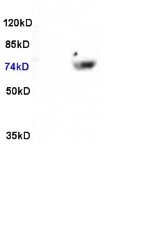 L1 Rat brain lysate L2 human colon carcinoma 30ug, probed (bs-1548R) at 1:200 in 4˚C. Followed by conjugation to the secondary antibody (bs-0295G-HRP) at 1:3000 90min in 37C. Predicted and observed band size: 74kDa.