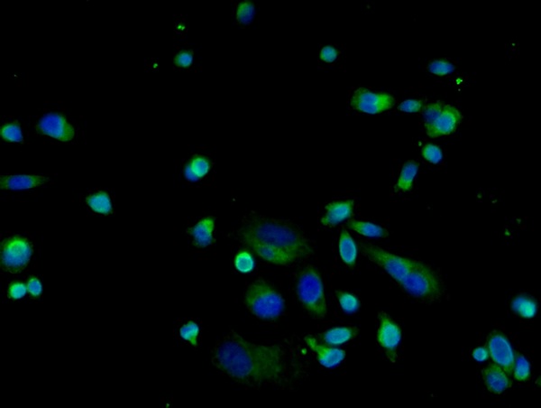 Image provided by One World Lab validation initiative. PC3 cells were stained with LAMP-1 Polyclonal Antibody, Unconjugated (bs-1970R) at [1:100] in PBS and incubated for one hour at room temperature, followed by secondary antibody incubation, DAPI staining of the nuclei and detection.