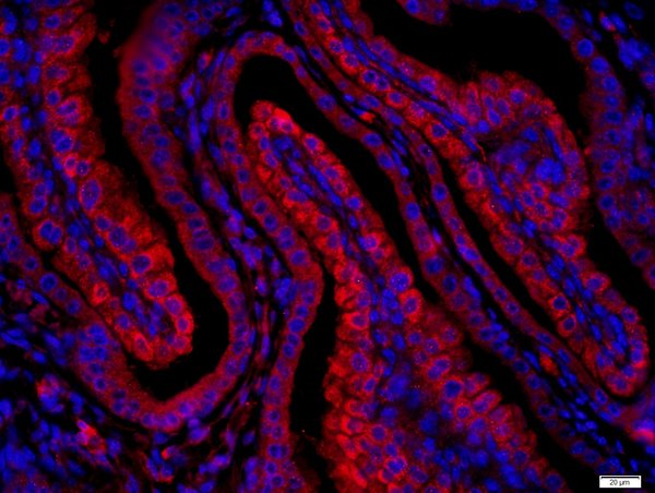 Paraformaldehyde-fixed, paraffin embedded mouse placenta; Antigen retrieval by boiling in sodium citrate buffer (pH6) for 15min; Block endogenous peroxidase by 3% hydrogen peroxide for 20 minutes; Blocking buffer (normal goat serum) at 37°C for 30min; Antibody incubation with (Layilin) Polyclonal Antibody, Unconjugated (bs-4629R) at 1:400 overnight at 4°C, followed by a conjugated secondary (Goat Anti-rabbit IgG/Bio) for 20minutes at 37°C, followed by a conjugated streptavidin for 40 minutes and DAPI staining of the nuclei.