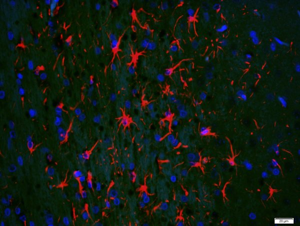 Paraformaldehyde-fixed, paraffin embedded rat brain; Antigen retrieval by boiling in sodium citrate buffer (pH6) for 15min; Block endogenous peroxidase by 3% hydrogen peroxide for 20 minutes; Blocking buffer (normal goat serum) at 37°C for 30min; Antibody incubation with GFAP Polyclonal Antibody, Unconjugated (bs-0199R) at 1:200 overnight at 4°C, followed by a conjugated secondary (bs-0295G-AF594) at 1:500 for 90 minutes and DAPI staining of the nuclei.