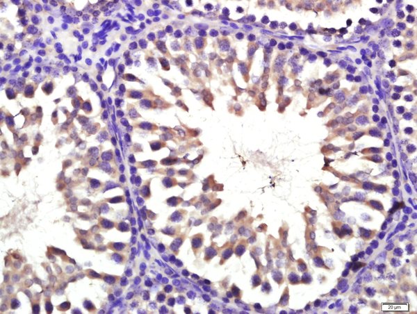 Paraformaldehyde-fixed, paraffin embedded rat testis; Antigen retrieval by boiling in sodium citrate buffer (pH6.0) for 15min; Block endogenous peroxidase by 3% hydrogen peroxide for 20 minutes; Blocking buffer (normal goat serum) at 37°C for 30min; Antibody incubation with CYP11B1 Polyclonal Antibody, Unconjugated (bs-3898R) at 1:400 overnight at 4°C, followed by a conjugated secondary for 20 minutes and DAB staining.