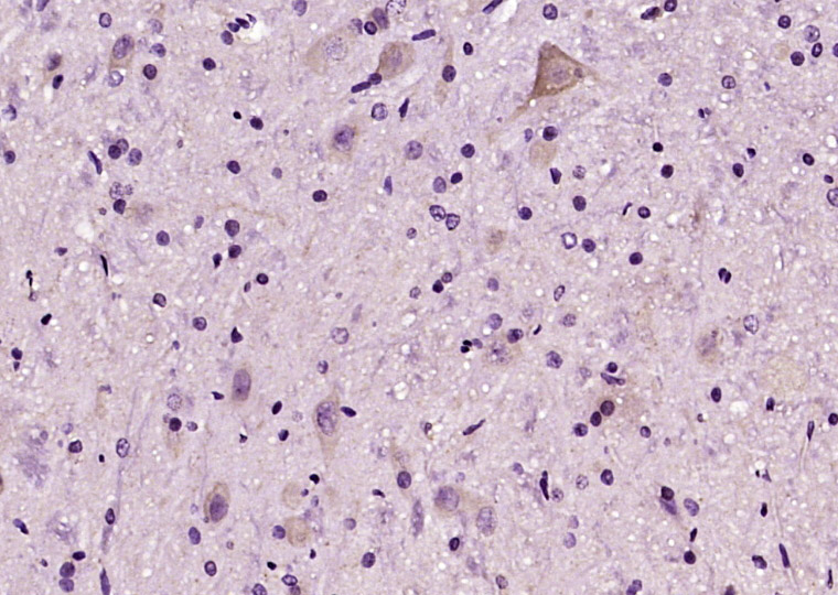 Paraformaldehyde-fixed, paraffin embedded Rat brain; Antigen retrieval by boiling in sodium citrate buffer (pH6.0) for 15min; Block endogenous peroxidase by 3% hydrogen peroxide for 20 minutes; Blocking buffer (normal goat serum) at 37°C for 30min; Antibody incubation with C6orf120 Polyclonal Antibody, Unconjugated (bs-9534R) at 1:200 overnight at 4°C, DAB staining.