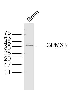 Mouse brain lysates probed with GPM6B Polyclonal Antibody, unconjugated (bs-11847R) at 1:300 overnight at 4°C followed by a conjugated secondary antibody at 1:10000 for 90 minutes at 37°C.