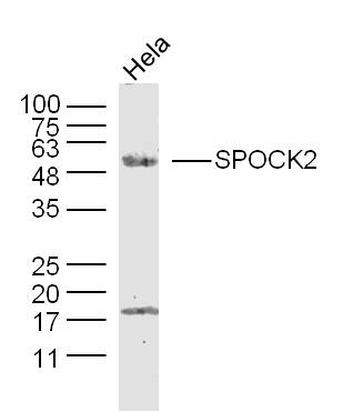 Human Hela cells probed with SPOCK2/Testican 2 Polyclonal Antibody, unconjugated (bs-11966R) at 1:300 overnight at 4°C followed by a conjugated secondary antibody at 1:10000 for 90 minutes at 37°C. Human Hela cells probed with SPOCK2/Testican 2 Polyclonal Antibody, unconjugated (bs-11966R) at 1:300 overnight at 4°C followed by a conjugated secondary antibody at 1:10000 for 90 minutes at 37°C.