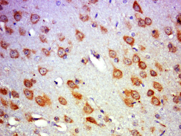 Paraformaldehyde-fixed, paraffin embedded rat brain; Antigen retrieval by boiling in sodium citrate buffer (pH6.0) for 15min; Block endogenous peroxidase by 3% hydrogen peroxide for 20 minutes; Blocking buffer (normal goat serum) at 37°C for 30min; Antibody incubation with PICALM/CALM Polyclonal Antibody, Unconjugated (bs-11665R) at 1:500 overnight at 4°C, followed by a conjugated secondary for 20 minutes and DAB staining.