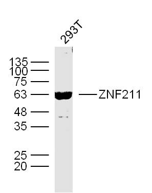 Human 293T cells probed with ZNF211 Polyclonal Antibody, unconjugated (bs-12230R) at 1:300 overnight at 4°C followed by a conjugated secondary antibody at 1:10000 for 90 minutes at 37°C.