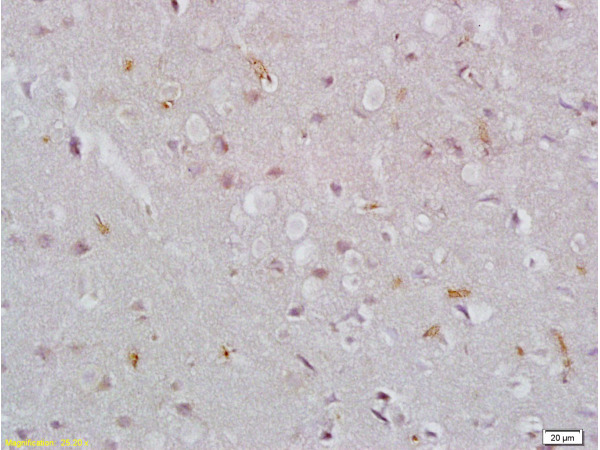 Formalin-fixed and paraffin embedded rat brain tissue labeled with Rabbit Anti-EpCAM\/CD326 Polyclonal Antibody (bs-0593R), Unconjugated at 1:200 followed by conjugation to the secondary antibody and DAB staining.