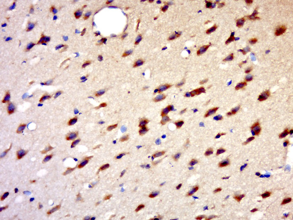 Paraformaldehyde-fixed, paraffin embedded rat brain; Antigen retrieval by boiling in sodium citrate buffer (pH6.0) for 15min; Block endogenous peroxidase by 3% hydrogen peroxide for 20 minutes; Blocking buffer (normal goat serum) at 37°C for 30min; Antibody incubation with HENMT1 Polyclonal Antibody, Unconjugated (bs-15454R) at 1:500 overnight at 4°C, followed by a conjugated secondary for 20 minutes and DAB staining