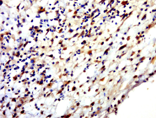Paraformaldehyde-fixed, paraffin embedded human skin; Antigen retrieval by boiling in sodium citrate buffer (pH6.0) for 15min; Block endogenous peroxidase by 3% hydrogen peroxide for 20 minutes; Blocking buffer (normal goat serum) at 37°C for 30min; Antibody incubation with HENMT1 Polyclonal Antibody, Unconjugated (bs-15454R) at 1:500 overnight at 4°C, followed by a conjugated secondary for 20 minutes and DAB staining.