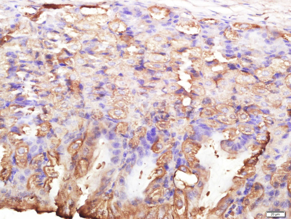 Paraformaldehyde-fixed, paraffin embedded mouse stomach; Antigen retrieval by boiling in sodium citrate buffer (pH6.0) for 15min; Block endogenous peroxidase by 3% hydrogen peroxide for 20 minutes; Blocking buffer (normal goat serum) at 37°C for 30min; Antibody incubation with PBR Polyclonal Antibody, Unconjugated (bs-3674R) at 1:400 overnight at 4°C, followed by a conjugated secondary for 20 minutes and DAB staining.