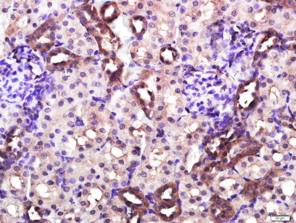 Paraformaldehyde-fixed, paraffin embedded rat kidney; Antigen retrieval by boiling in sodium citrate buffer (pH6.0) for 15min; Block endogenous peroxidase by 3% hydrogen peroxide for 20 minutes; Blocking buffer (normal goat serum) at 37°C for 30min; Antibody incubation with CD4 Polyclonal Antibody, Unconjugated (bs-0647R) at 1:400 overnight at 4°C, followed by a conjugated secondary for 20 minutes and DAB staining.
