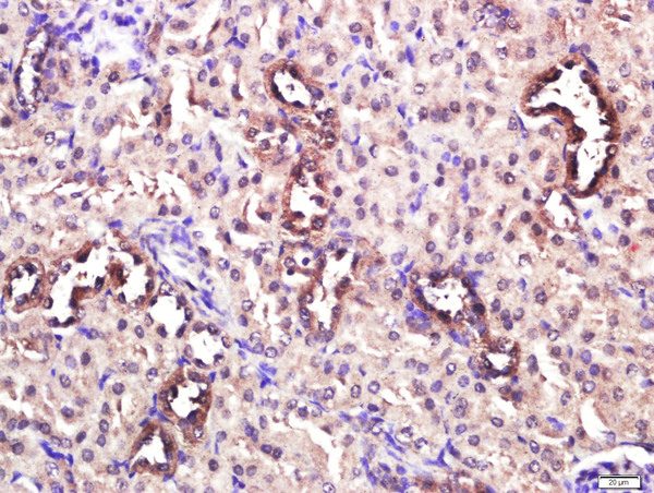 Paraformaldehyde-fixed, paraffin embedded mouse kidney; Antigen retrieval by boiling in sodium citrate buffer (pH6.0) for 15min; Block endogenous peroxidase by 3% hydrogen peroxide for 20 minutes; Blocking buffer (normal goat serum) at 37°C for 30min; Antibody incubation with CD4 Polyclonal Antibody, Unconjugated (bs-0647R) at 1:400 overnight at 4°C, followed by a conjugated secondary for 20 minutes and DAB staining.