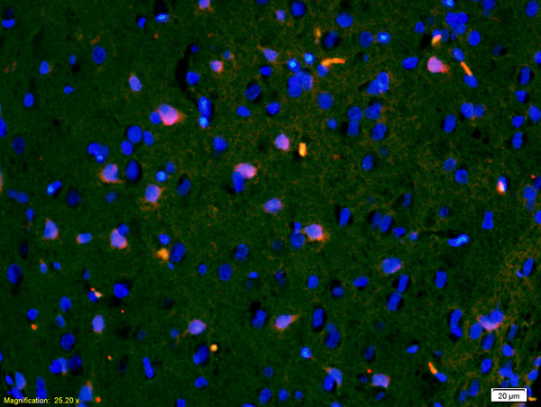 Formalin-fixed and paraffin-embedded rat brain labeled with Anti-IGFBP3 Polyclonal Antibody, Unconjugated(bs-1434R) 1:200, overnight at 4\u00b0C, The secondary antibody was Goat Anti-Rabbit IgG,Cy3 conjugated(bs-0295G-Cy3)used at 1:200 dilution for 40 minutes at 37\u00b0C.