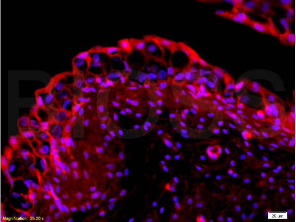 Formalin-fixed and paraffin embedded rabbit bladder tissue labeled with Rabbit Anti-EpCAM/CD326 Polyclonal Antibody (bs-0593R), Unconjugated at 1:200 followed by conjugation to the secondary antibody and DAB staining.