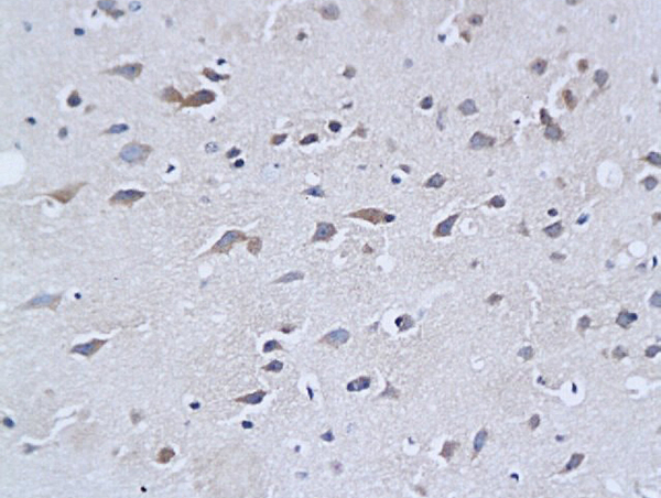 Formalin-fixed and paraffin embedded mouse brain tissue labeled with Rabbit Anti-NF-H\/Neurofilament H\/Neurofilament 200 Polyclonal Antibody (bs-0708R), Unconjugated followed by conjugation to the secondary antibody and DAB staining