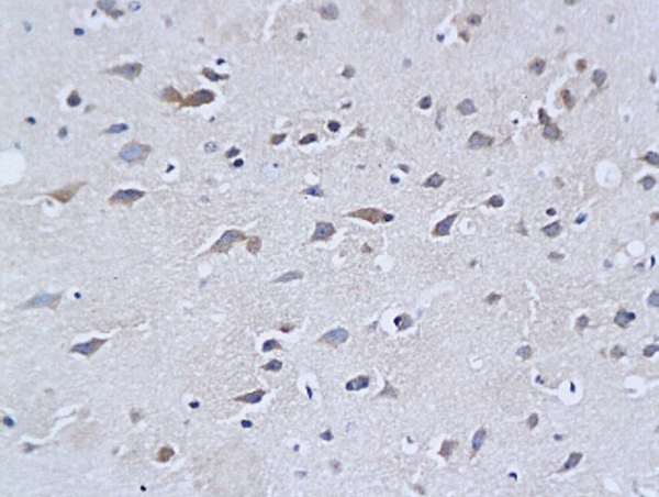 Formalin-fixed and paraffin embedded mouse brain tissue labeled with Rabbit Anti-NF-H/Neurofilament H/Neurofilament 200 Polyclonal Antibody (bs-0708R), Unconjugated followed by conjugation to the secondary antibody and DAB staining