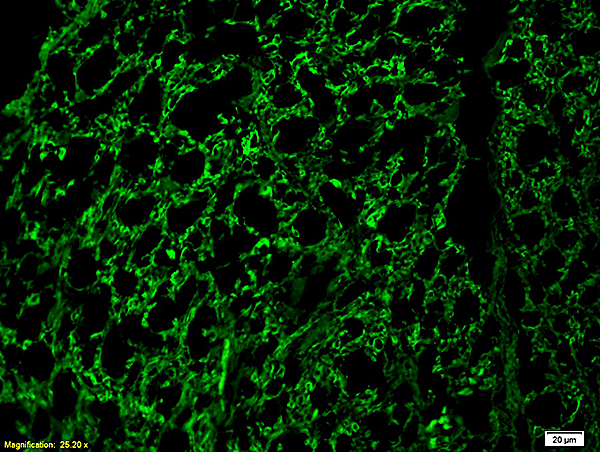 Formalin-fixed and paraffin embedded rat spinal cord labeled with Rabbit Anti-NF-H/Neurofilament H/Neurofilament 200 Polyclonal Antibody (bs-0708R), Unconjugated 1:200 followed by conjugation to the secondary antibody and DAB staining.