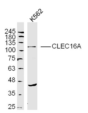 Human K562 cells probed with CLEC16A Polyclonal Antibody, unconjugated (bs-18539R) at 1:300 overnight at 4°C followed by a conjugated secondary antibody at 1:10000 for 90 minutes at 37°C. Human K562 cells probed with CLEC16A Polyclonal Antibody, unconjugated (bs-18539R) at 1:300 overnight at 4°C followed by a conjugated secondary antibody at 1:10000 for 90 minutes at 37°C.