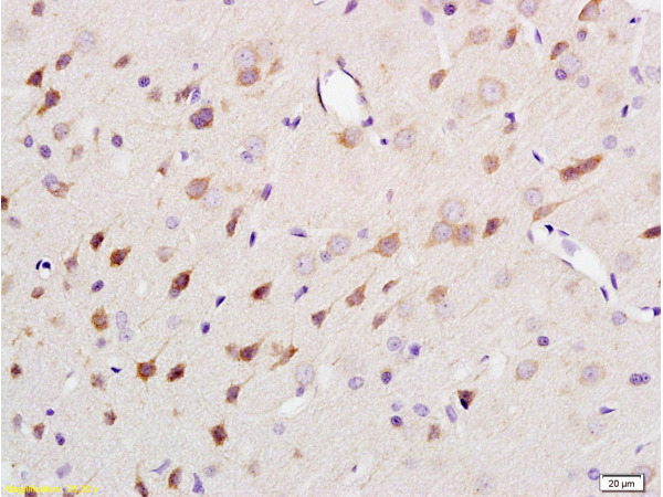 Formalin-fixed and paraffin embedded rat brain tissue labeled Anti-NF-H\/Neurofilament H\/Neurofilament 200 Polyclonal Antibody (bs-0708R), Unconjugated at 1:200, followed by conjugation to the secondary antibody and DAB staining