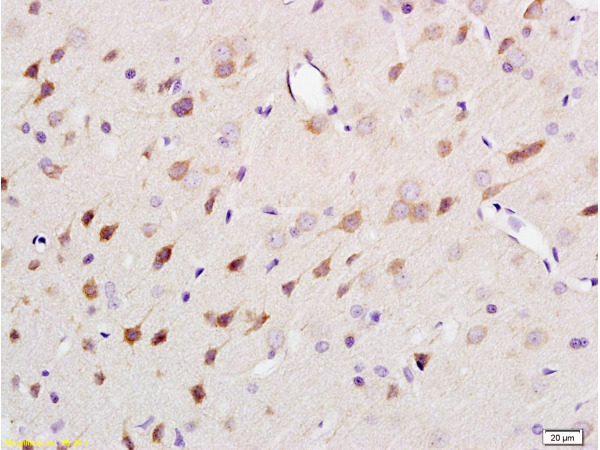 Formalin-fixed and paraffin embedded rat brain tissue labeled Anti-NF-H/Neurofilament H/Neurofilament 200 Polyclonal Antibody (bs-0708R), Unconjugated at 1:200, followed by conjugation to the secondary antibody and DAB staining