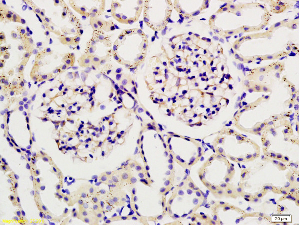 Formalin-fixed and paraffin embedded rat kidney tissue labeled with Rabbit Anti-Podoplanin/gp36 Polyclonal Antibody (bs-1048R), Unconjugated 1:200 followed by conjugation to the secondary antibody and DAB staining