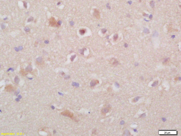 Formalin-fixed and paraffin embedded rat brain labeled with Anti- TSHR(NT)  Polyclonal Antibody, Unconjugated (bs-0003R) at 1:200 followed by conjugation to the secondary antibody and DAB staining