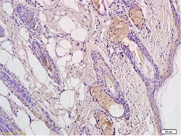 Formalin-fixed and paraffin embedded rat skin labeled with Rabbit Anti-CD4 Polyclonal Antibody, Unconjugated(bs-0766R) 1:300 followed by conjugation to the secondary antibody and DAB staining. Formalin-fixed and paraffin embedded rat skin labeled with Rabbit Anti-CD4 Polyclonal Antibody, Unconjugated(bs-0766R) 1:300 followed by conjugation to the secondary antibody and DAB staining.