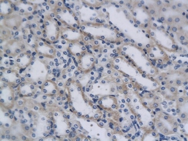 Formalin-fixed and paraffin embedded mouse kidney cells labeled with Rabbit Anti-CD4 Polyclonal Antibody, Unconjugated (bs-0766R) 1:200 followed by conjugation to the secondary antibody and DAB staining.