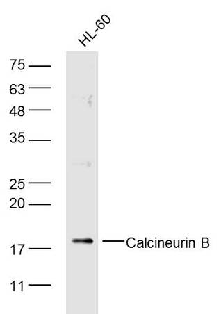 Human HL-60 cells probed with Calcineurin B Polyclonal Antibody, unconjugated (bs-11246R) at 1:300 overnight at 4°C followed by a conjugated secondary antibody at 1:10000 for 90 minutes at 37°C.\n