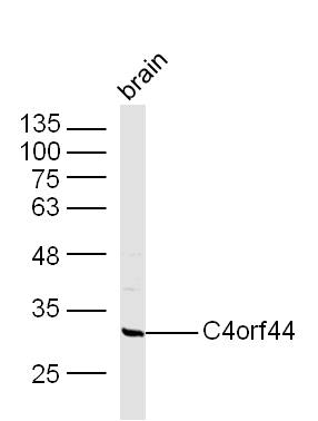 Mouse Brain lysates probed with C4orf44 Polyclonal Antibody, Unconjugated (bs-9998R) at 1:300 overnight at 4˚C. Followed by a conjugated secondary antibody at 1:10000 for 60 min at 37˚C.