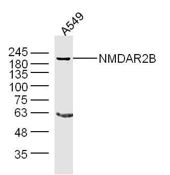 A549 lysates probed with NMDAR2B Polyclonal Antibody, Unconjugated (bs-0222R) at 1:300 overnight at 4˚C. Followed by a conjugated secondary antibody at 1:10000 for 60 min at 37˚C.