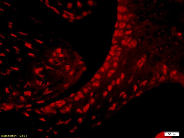 Formalin-fixed and paraffin embedded Lymphocytes labeled with (bs-0766R) Rabbit Anti-CD4 Polyclonal Antibody, Unconjugated followed by incubation with a conjugated secondary antibody.