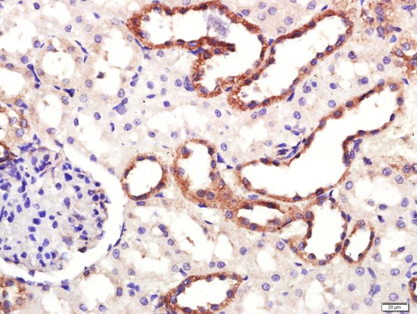 Paraformaldehyde-fixed, paraffin embedded rat kidney; Antigen retrieval by boiling in sodium citrate buffer (pH6.0) for 15min; Block endogenous peroxidase by 3% hydrogen peroxide for 20 minutes; Blocking buffer (normal goat serum) at 37°C for 30min; Antibody incubation with Dopamine Transporter Polyclonal Antibody, Unconjugated (bs-1714R) at 1:400 overnight at 4°C, followed by a conjugated secondary for 20 minutes and DAB staining.
