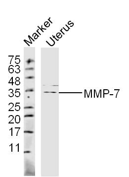 Mouse Uterus lysates probed with MMP-7 Polyclonal Antibody, unconjugated (bs-0423R) at 1:300 overnight at 4\u00b0C followed by a conjugated secondary antibody at 1:10000 for 60 minutes at 37\u00b0C.