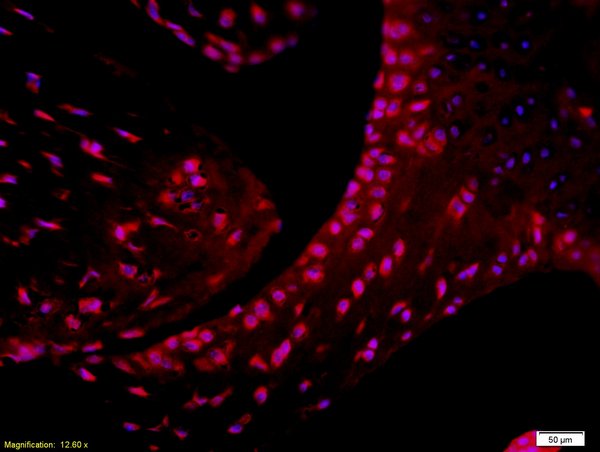 Formalin-fixed and paraffin embedded Lymphocytes labeled with Rabbit Anti-CD4 Polyclonal Antibody, Unconjugated(bs-0766R) followed by incubation with a conjugated secondary antibody and DAPI staining.