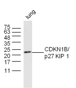 Mouse lung lysates probed with CDKN1B Polyclonal Antibody, unconjugated (bs-0742R) at 1:300 overnight at 4°C followed by a conjugated secondary antibody at 1:10000 for 60 minutes at 37°C.