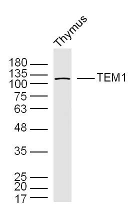 Mouse thymus lysates probed with TEM1 Polyclonal Antibody, unconjugated (bs-2101R) at 1:300 overnight at 4°C followed by a conjugated secondary antibody at 1:10000 for 90 minutes at 37°C.